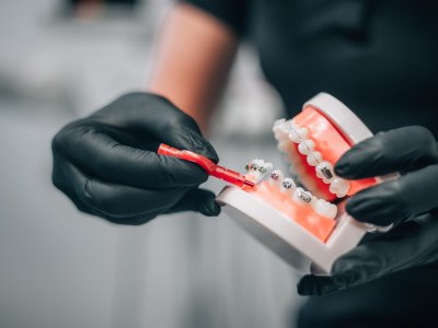 10 mýtů o rovnátkách, kterým lidé stále věří. Pravda o ortodoncii: rovnátka pro děti i dospělé, od kovových po Invisalign.
